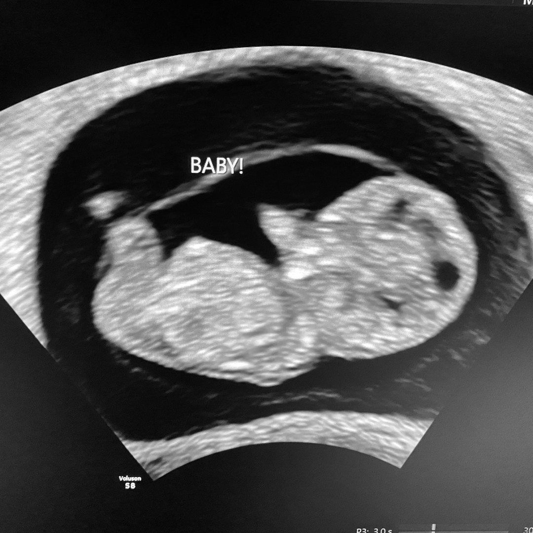 Photo shared by Stacey for their Babylist baby registry.