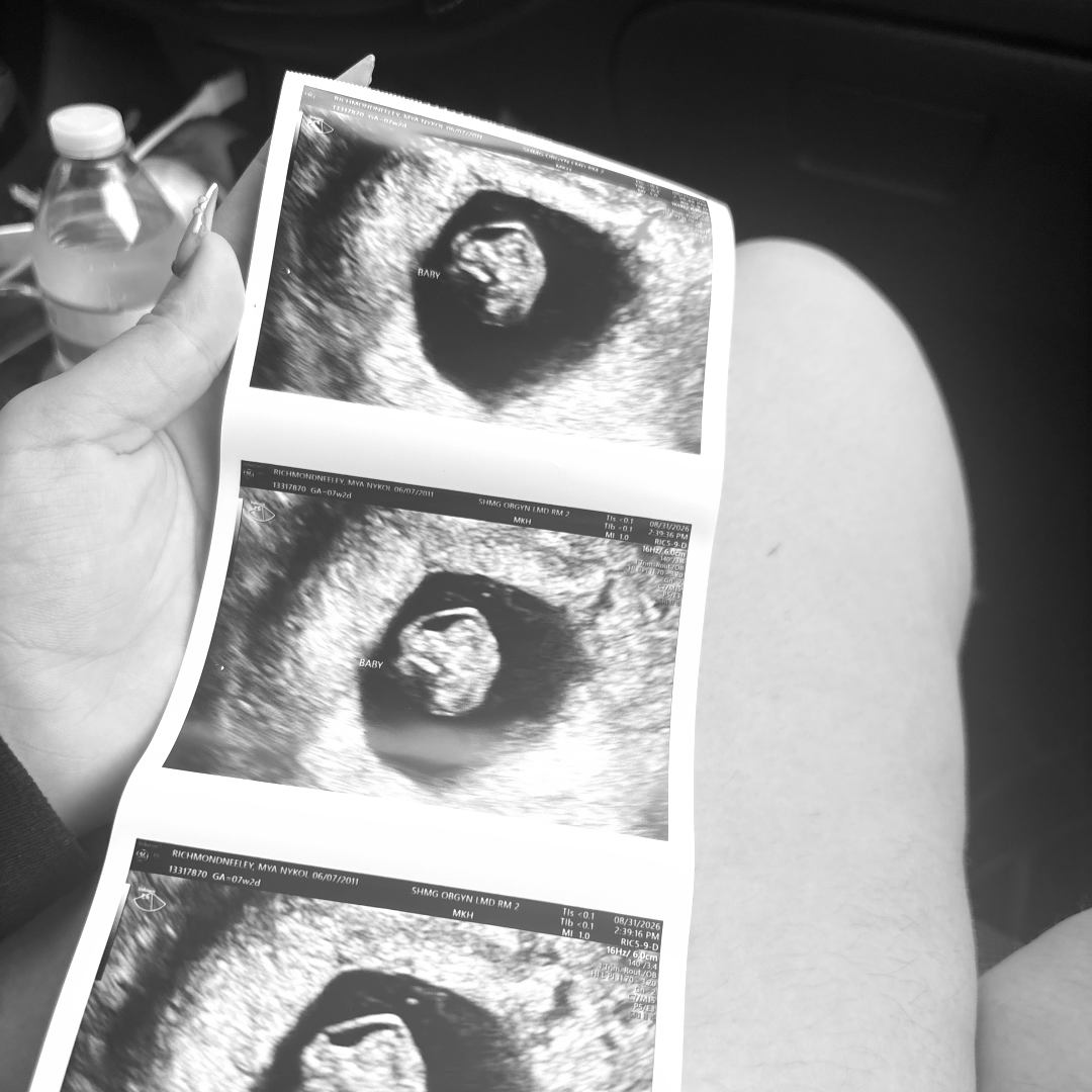 Photo shared by Myasia for their Babylist baby registry.