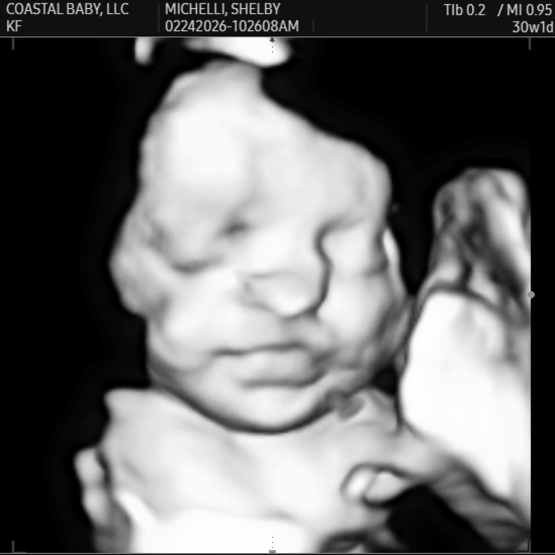 Photo shared by Shelby for their Babylist baby registry.