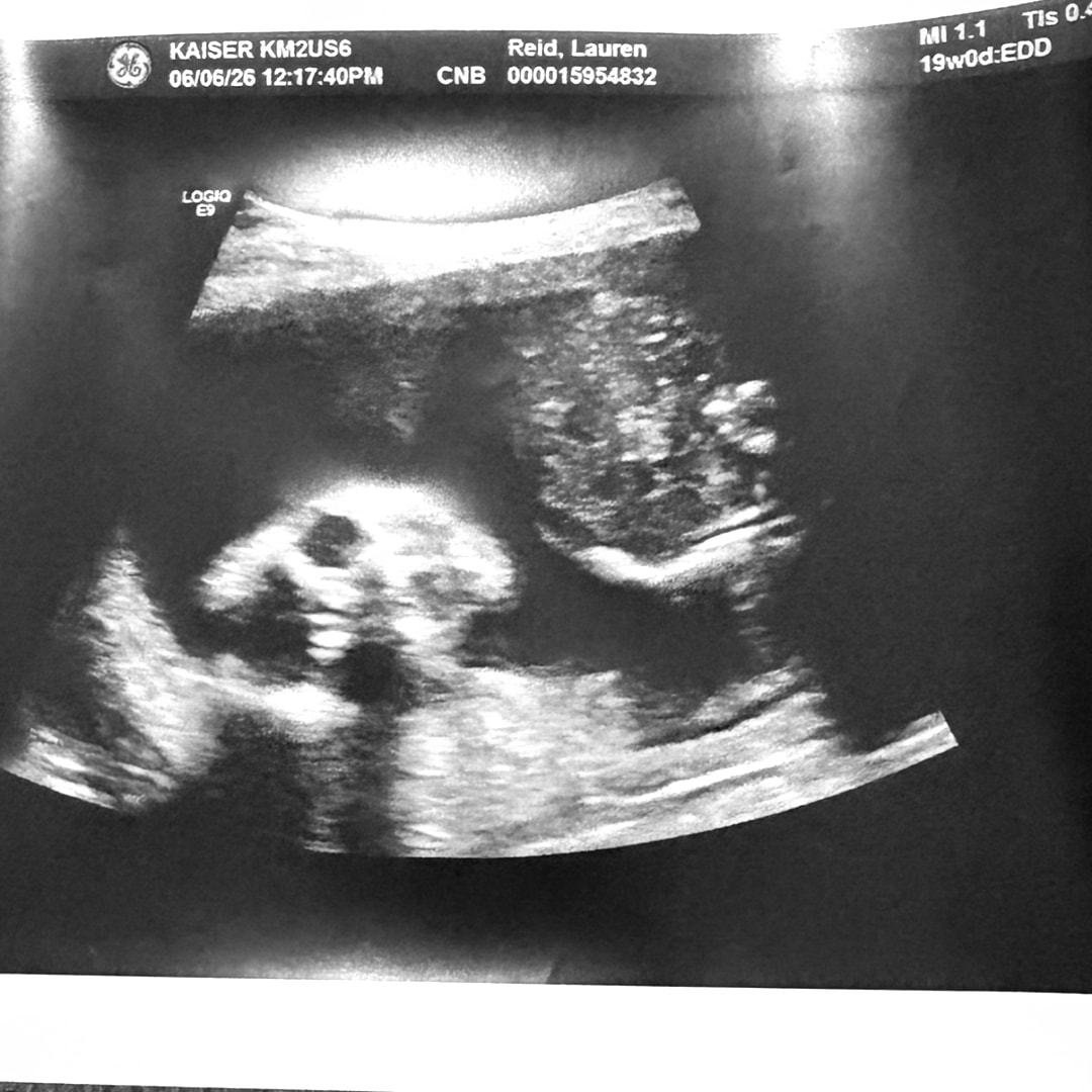 Photo shared by Lauren for their Babylist baby registry.