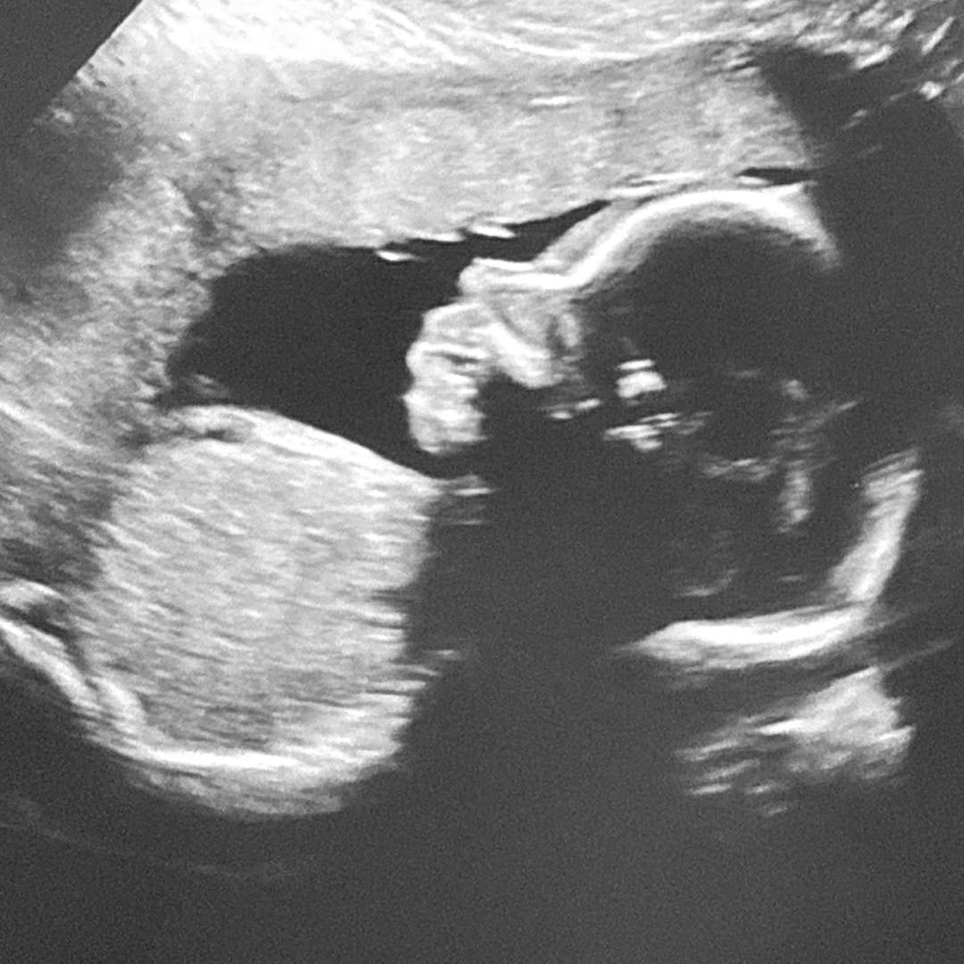 Photo shared by Sarah for their Babylist baby registry.