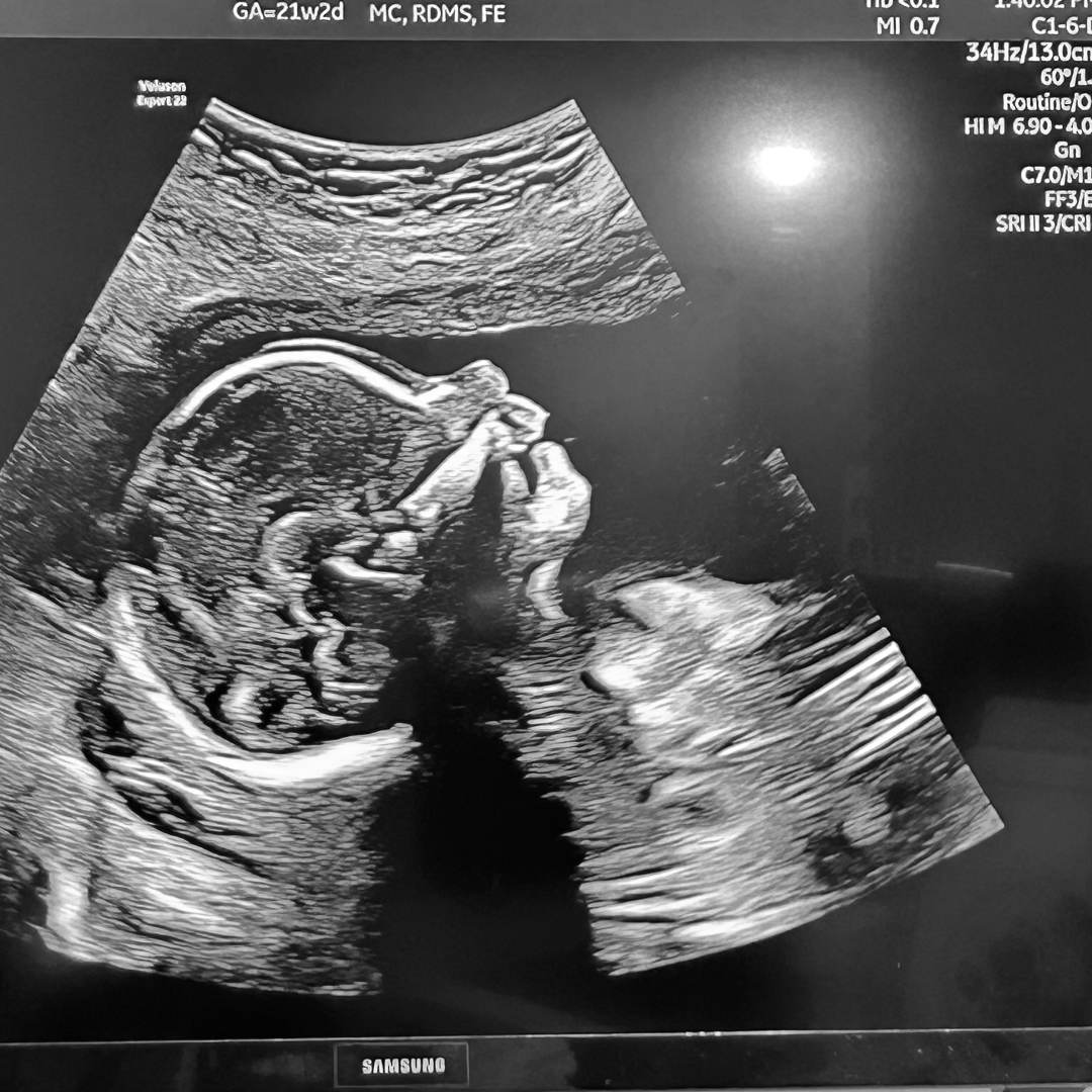 Photo shared by Alicia for their Babylist baby registry.