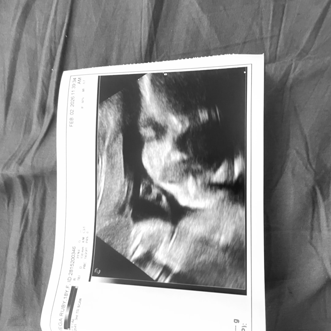 Photo shared by Ruby for their Babylist baby registry.