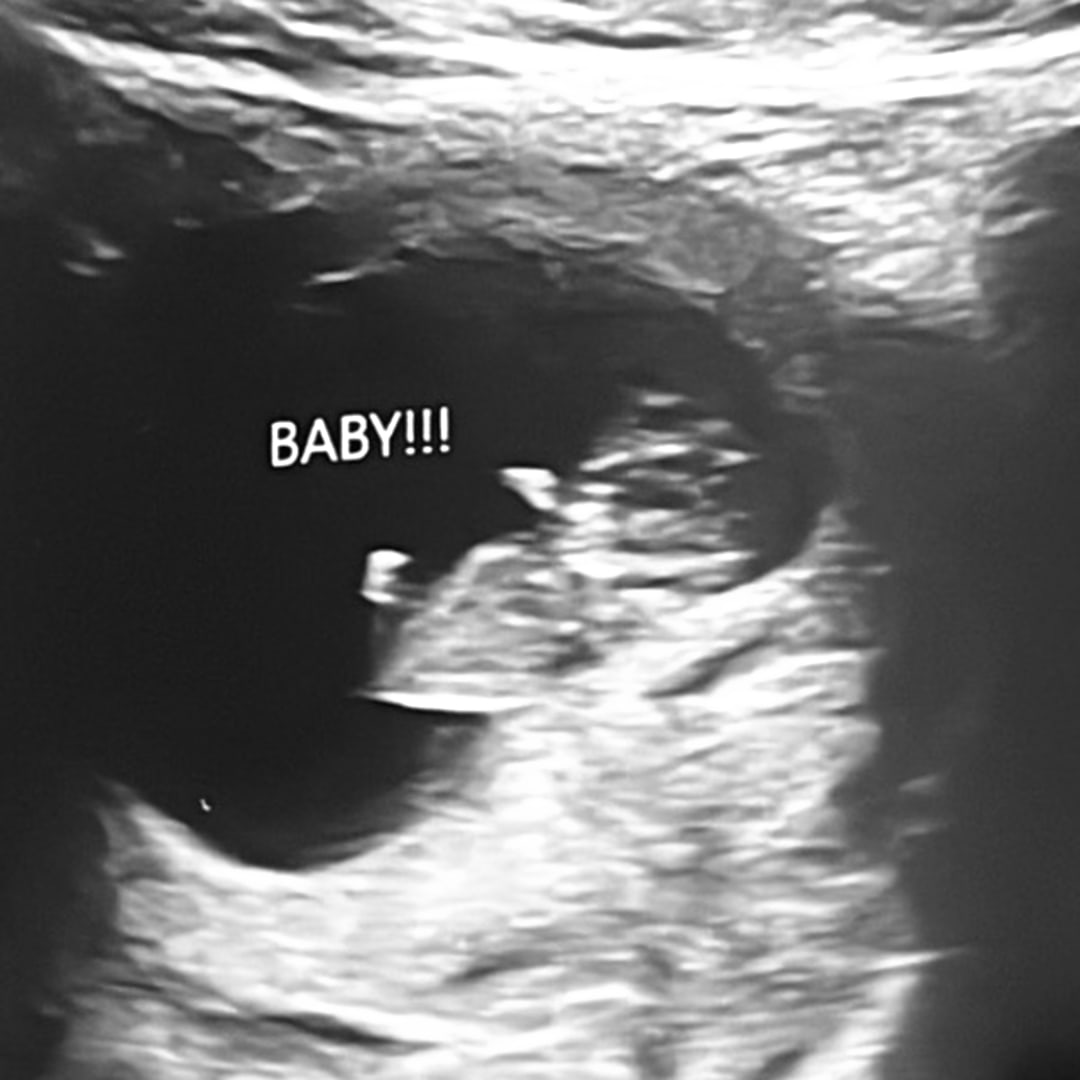 Photo shared by Sarah for their Babylist baby registry.