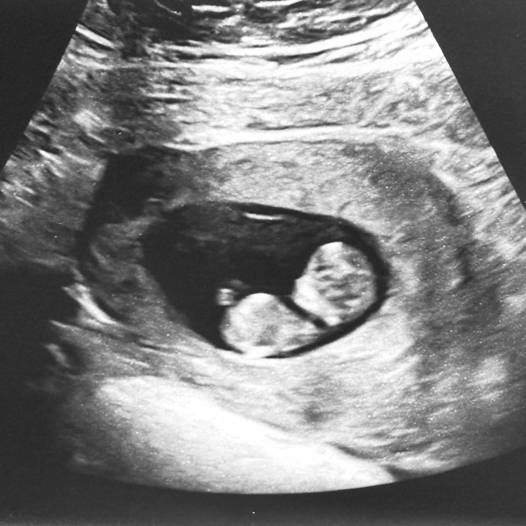Photo shared by Diana for their Babylist baby registry.
