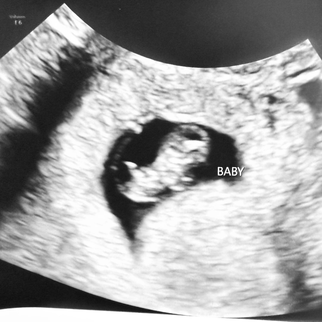 Photo shared by Devon for their Babylist baby registry.