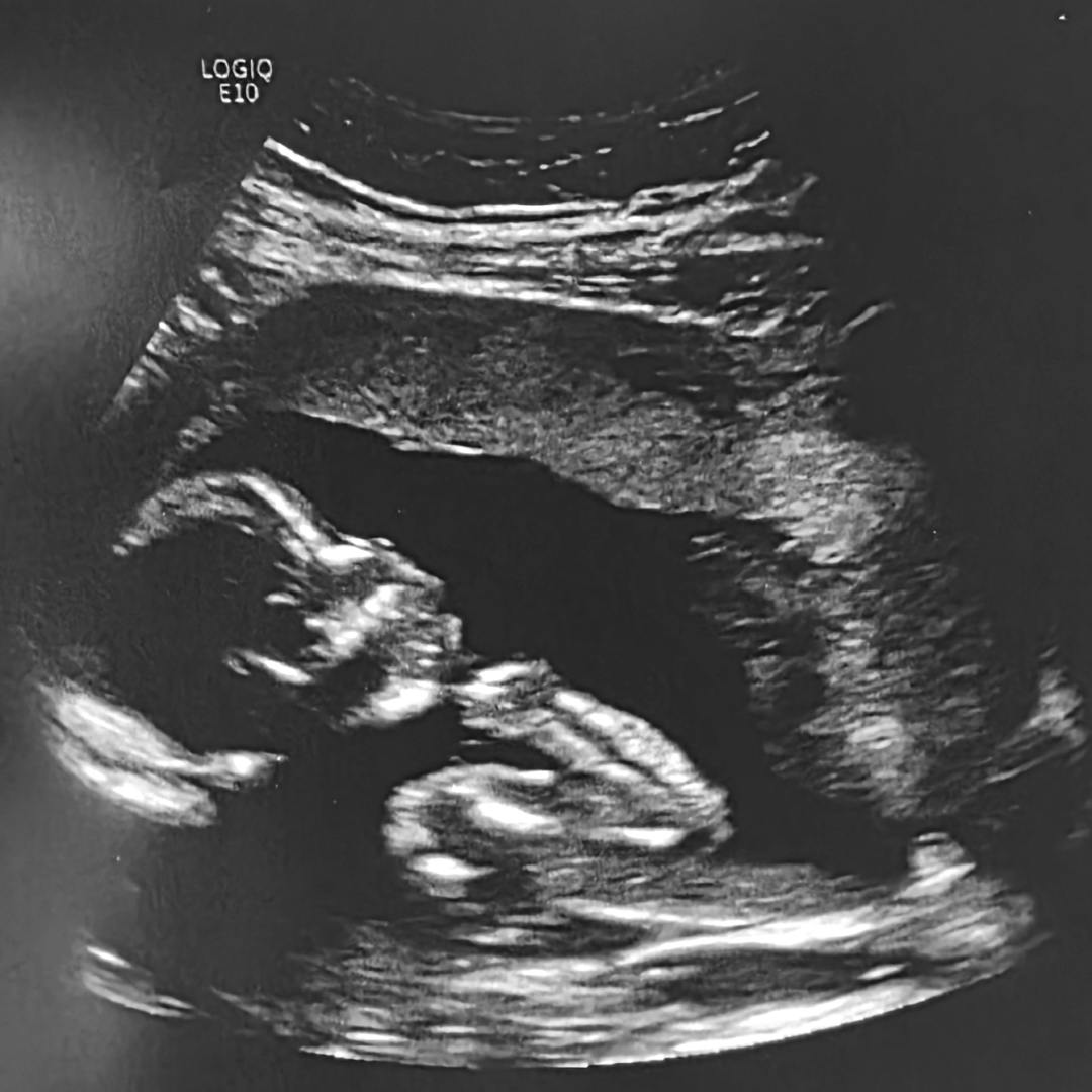 Photo shared by Joao for their Babylist baby registry.