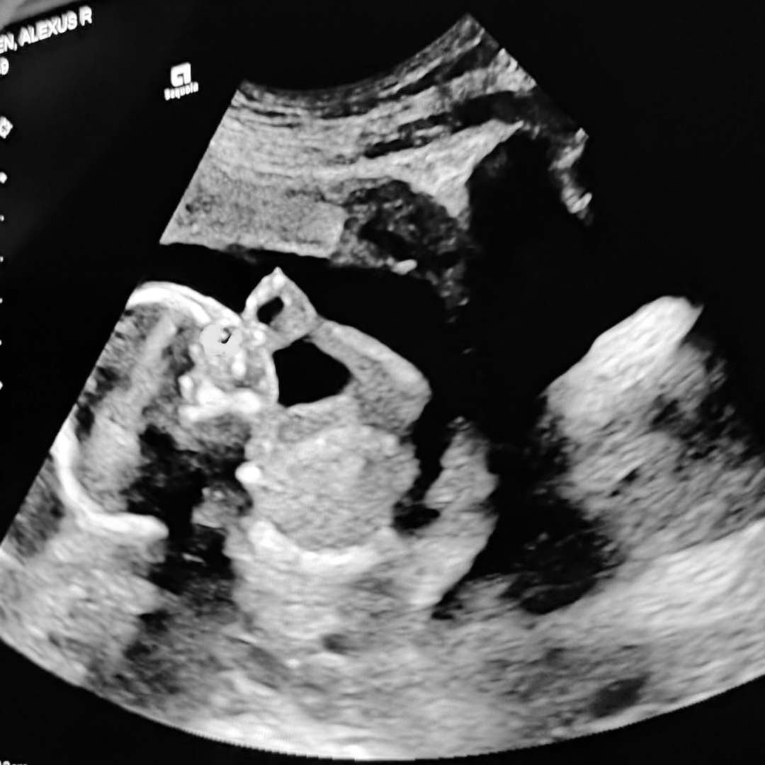 Photo shared by Alex for their Babylist baby registry.