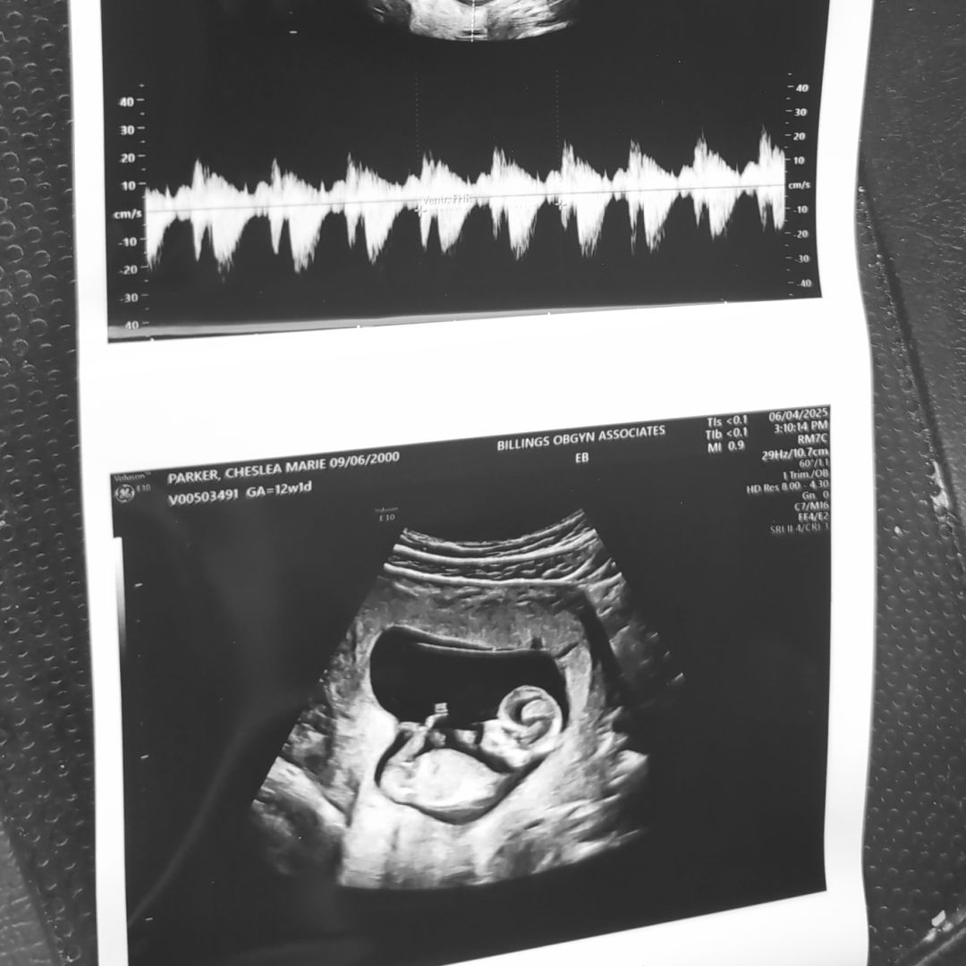 Photo shared by Cheslea for their Babylist baby registry.
