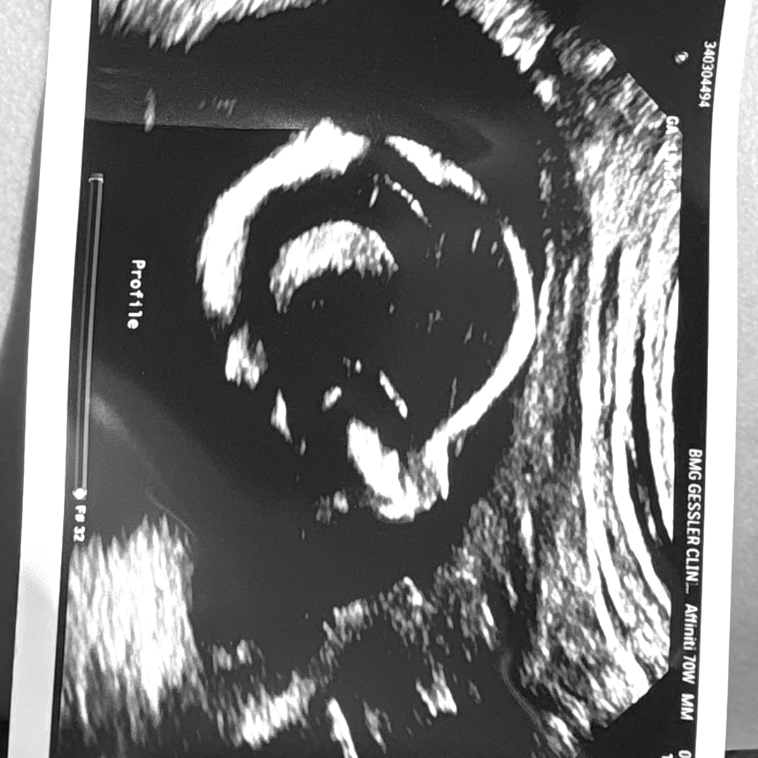 Photo shared by Emma and Levi for their Babylist baby registry.