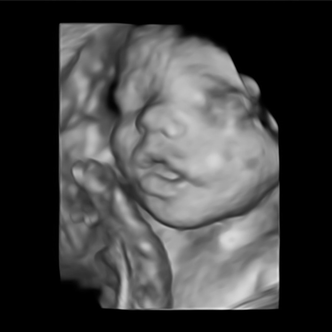 Photo shared by Anna for their Babylist baby registry.