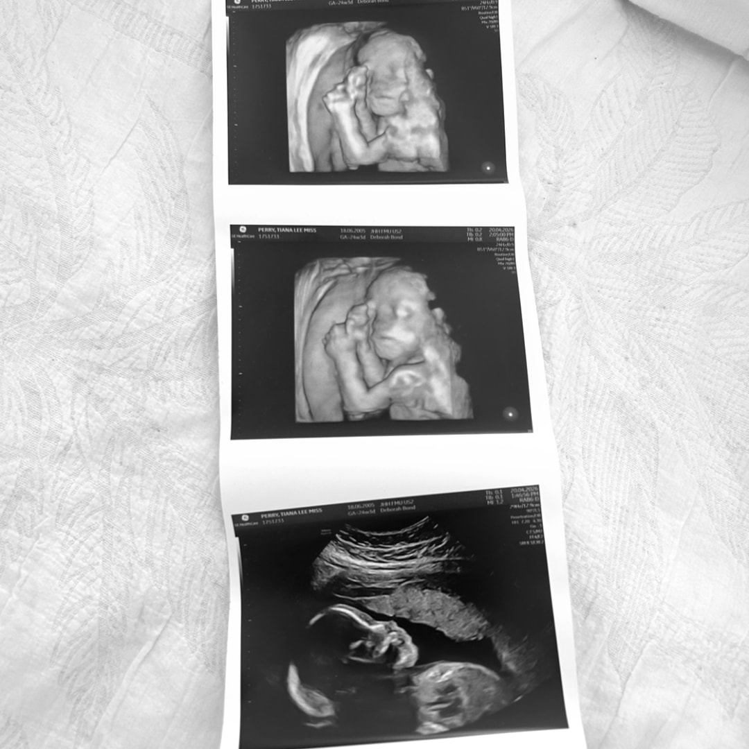 Photo shared by Tiana for their Babylist baby registry.