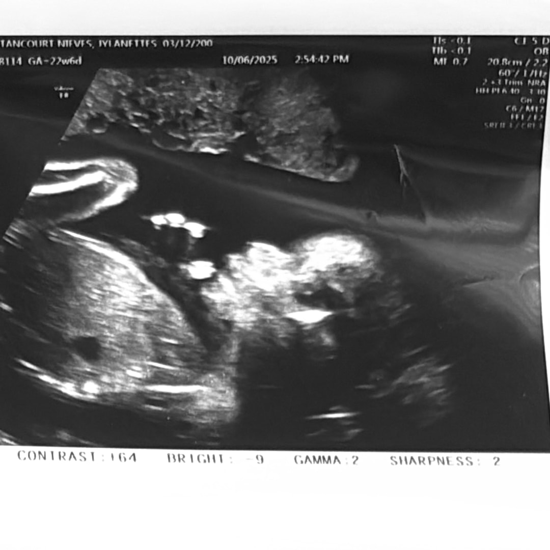 Photo shared by Jylanettes for their Babylist baby registry.