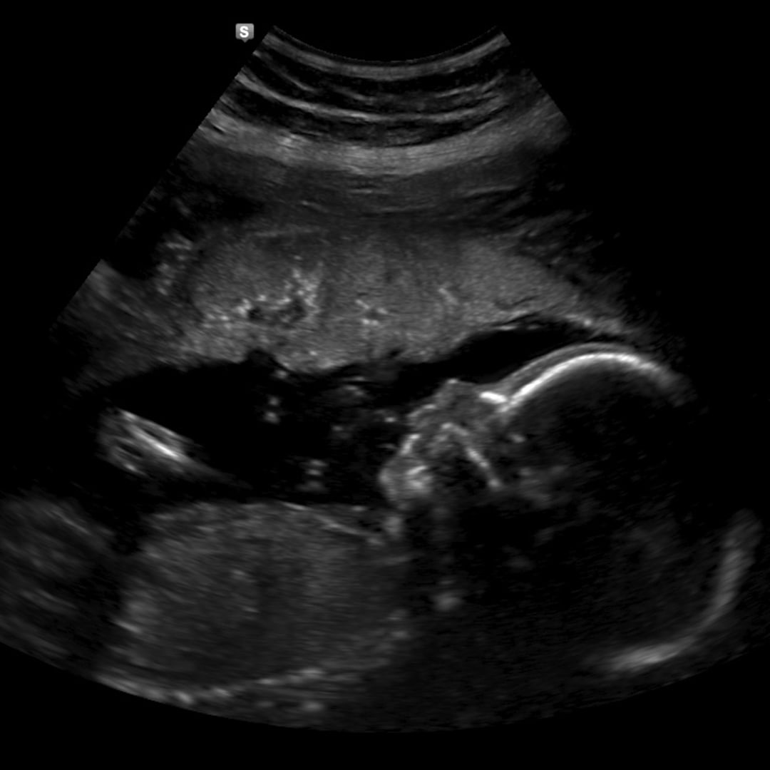 Photo shared by Lauren for their Babylist baby registry.