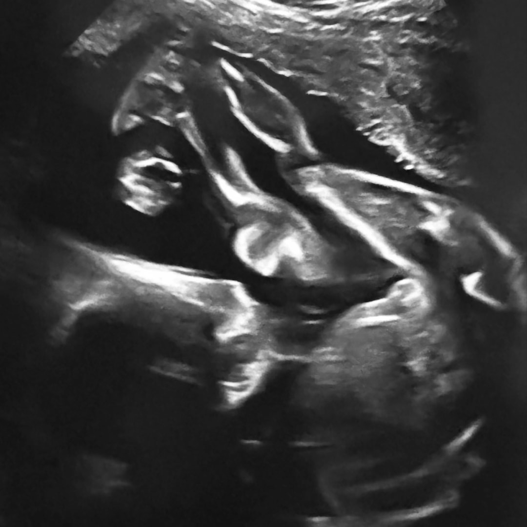 Photo shared by Ashlyn for their Babylist baby registry.