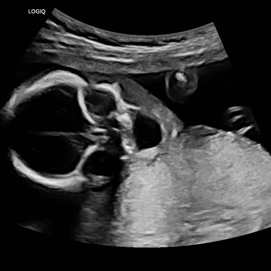 Photo shared by Haylee for their Babylist baby registry.