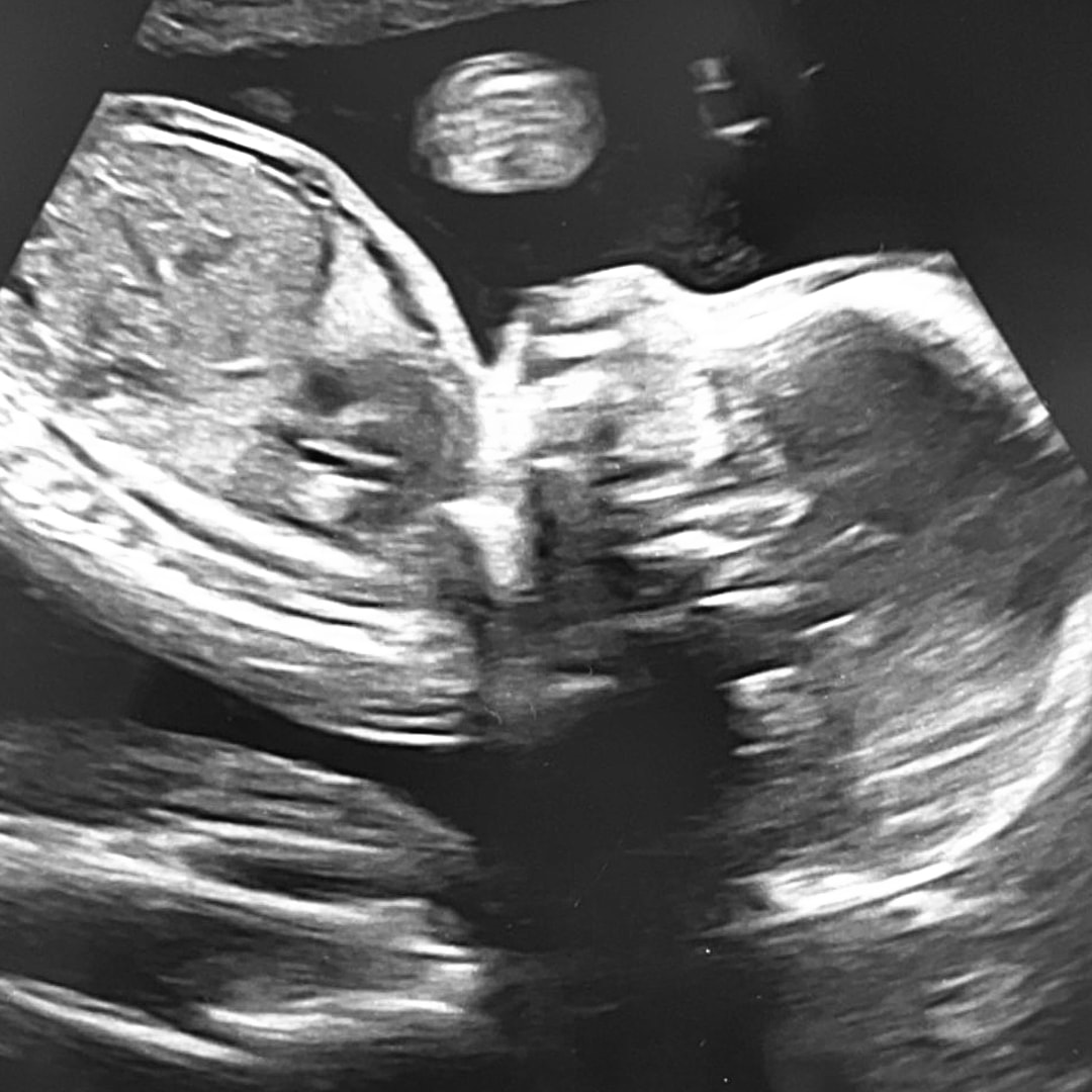 Photo shared by Magdalen for their Babylist baby registry.