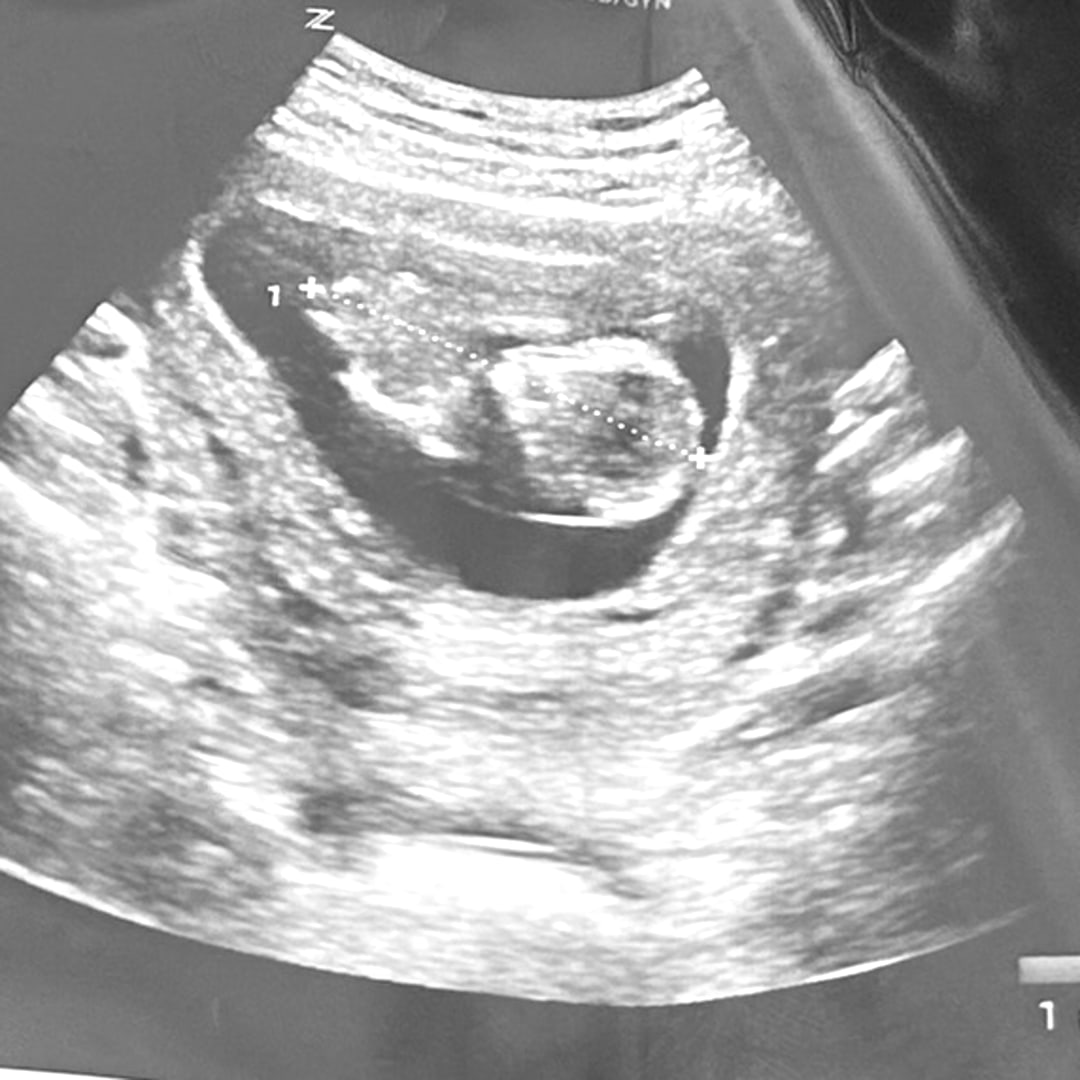 Photo shared by Pichaya for their Babylist baby registry.