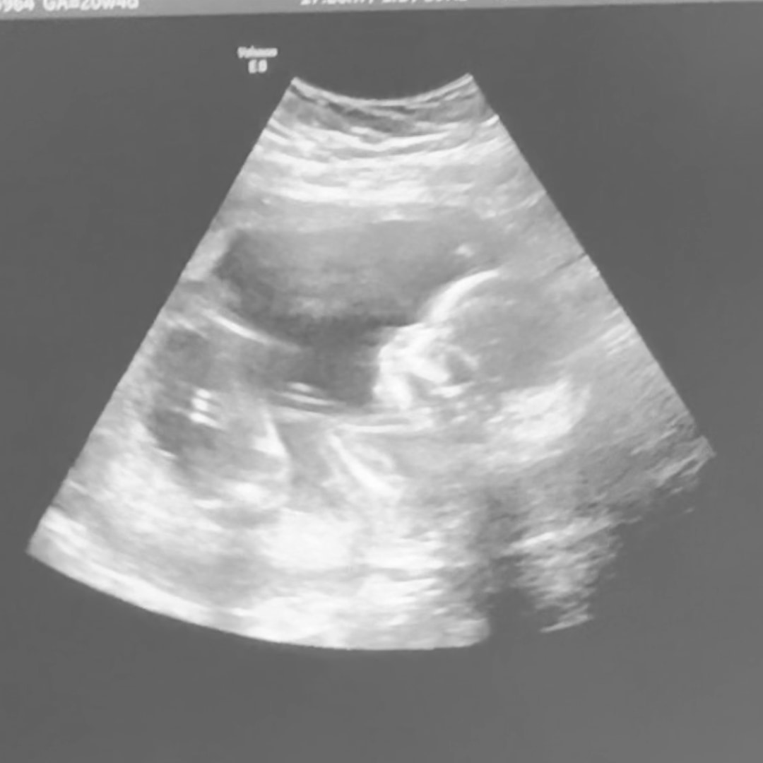 Photo shared by Kayla for their Babylist baby registry.