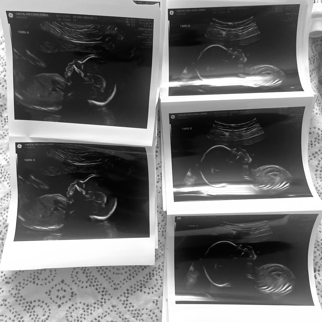 Photo shared by Precious for their Babylist baby registry.