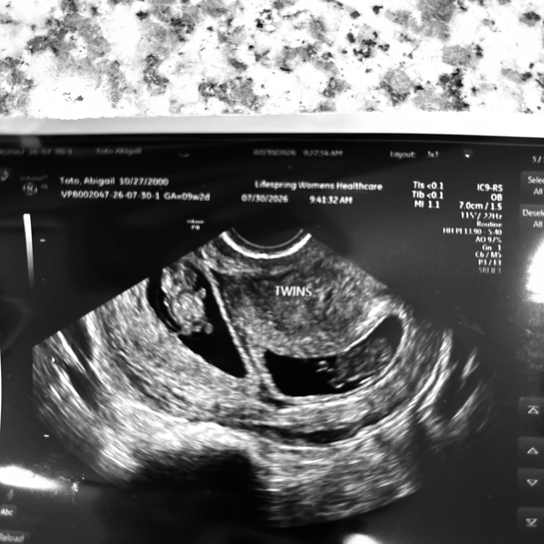 Photo shared by Abi for their Babylist baby registry.