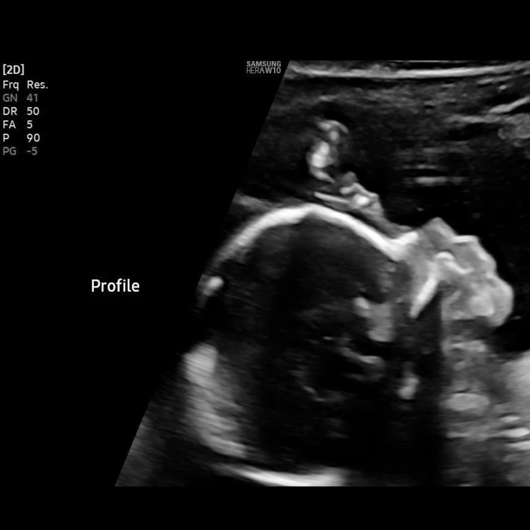 Photo shared by Julia for their Babylist baby registry.