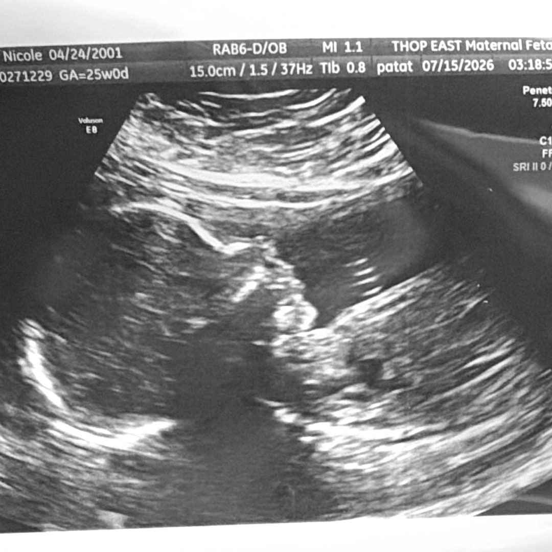 Photo shared by Nicole for their Babylist baby registry.