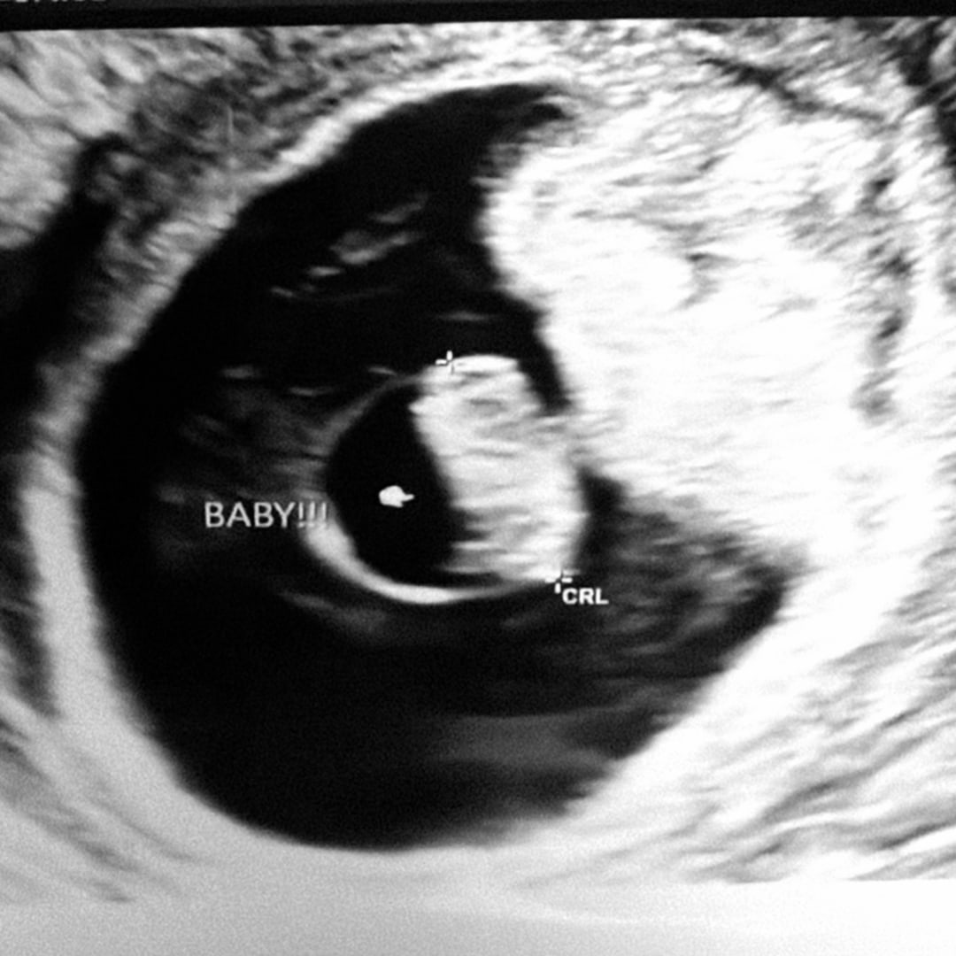 Photo shared by Morgan for their Babylist baby registry.