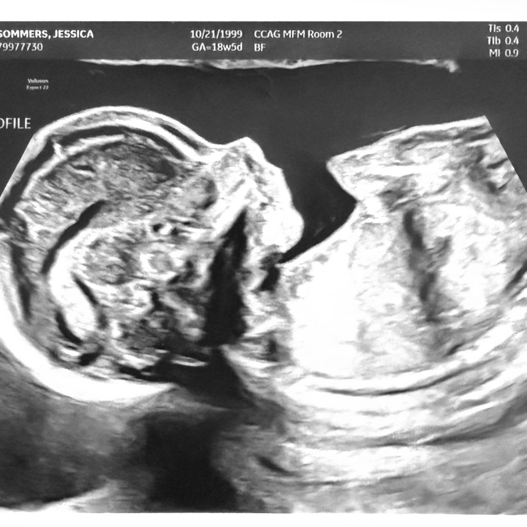 Photo shared by Jessica for their Babylist baby registry.