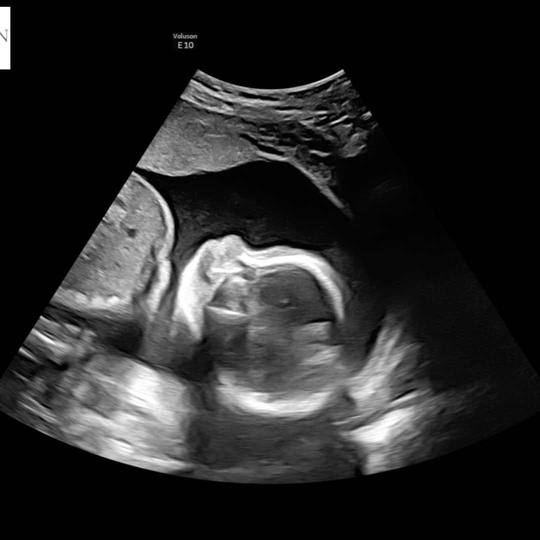 Photo shared by Shyann for their Babylist baby registry.