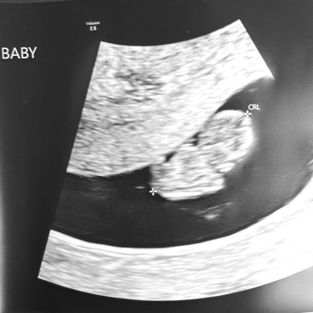 Photo shared by Andrea for their Babylist baby registry.