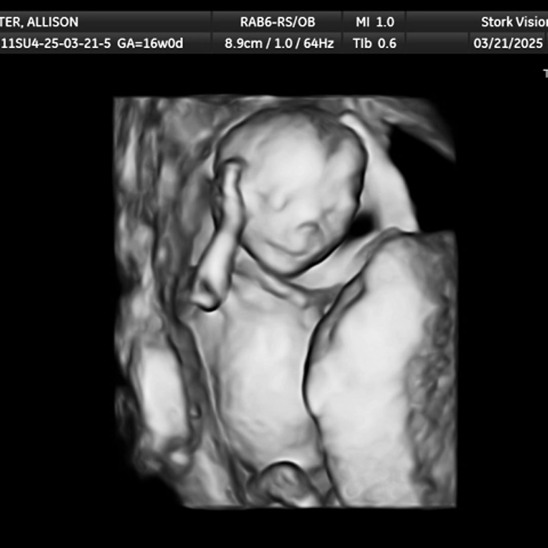 Photo shared by Allison for their Babylist baby registry.
