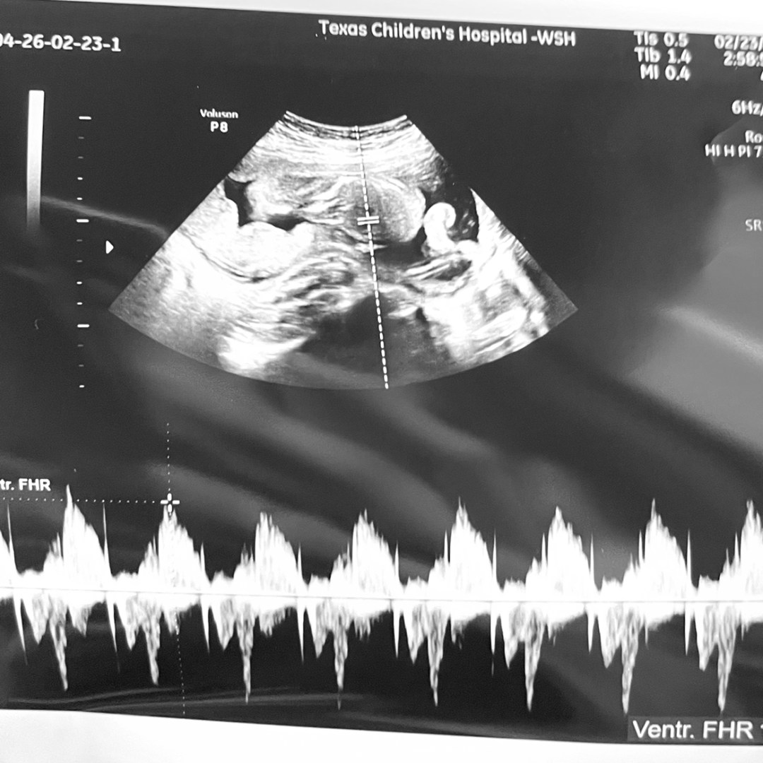 Photo shared by Claudia for their Babylist baby registry.