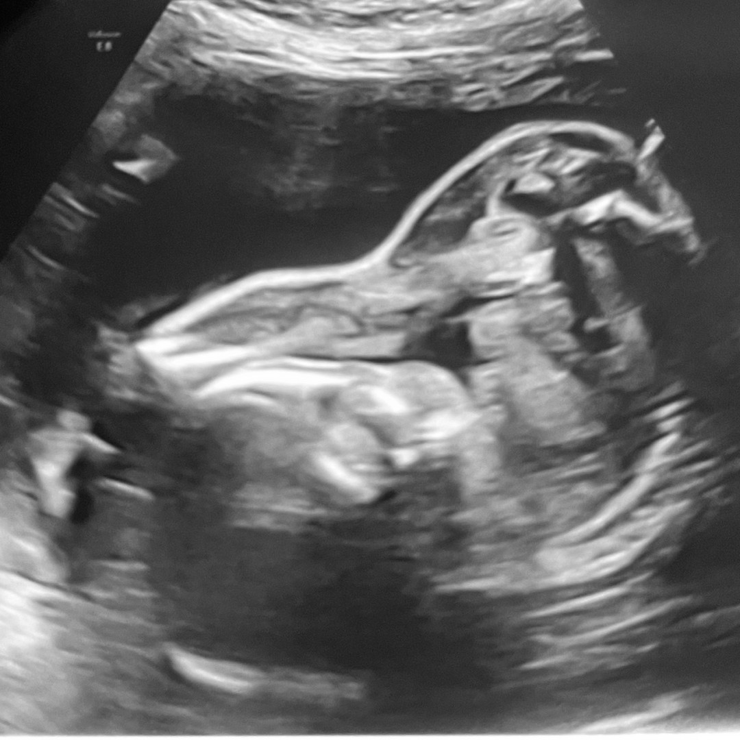 Photo shared by Chasity for their Babylist baby registry.