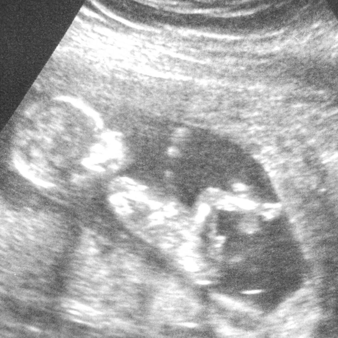 Photo shared by Jayden for their Babylist baby registry.