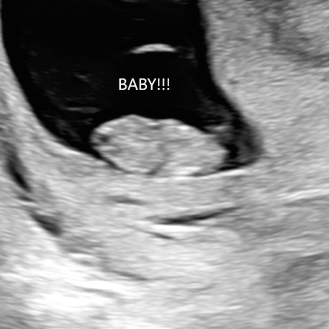Photo shared by Heather for their Babylist baby registry.