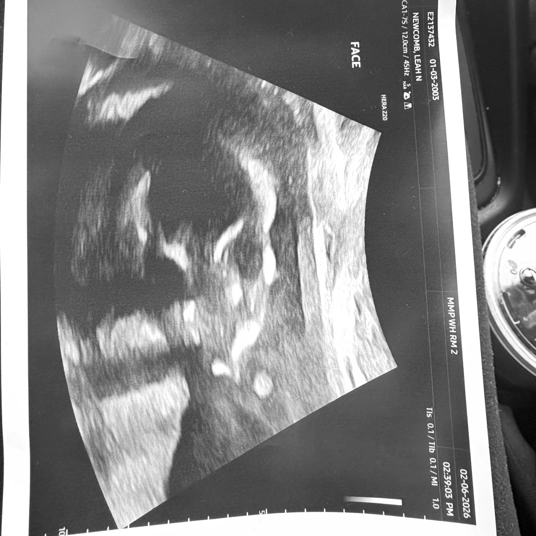 Photo shared by Leah for their Babylist baby registry.