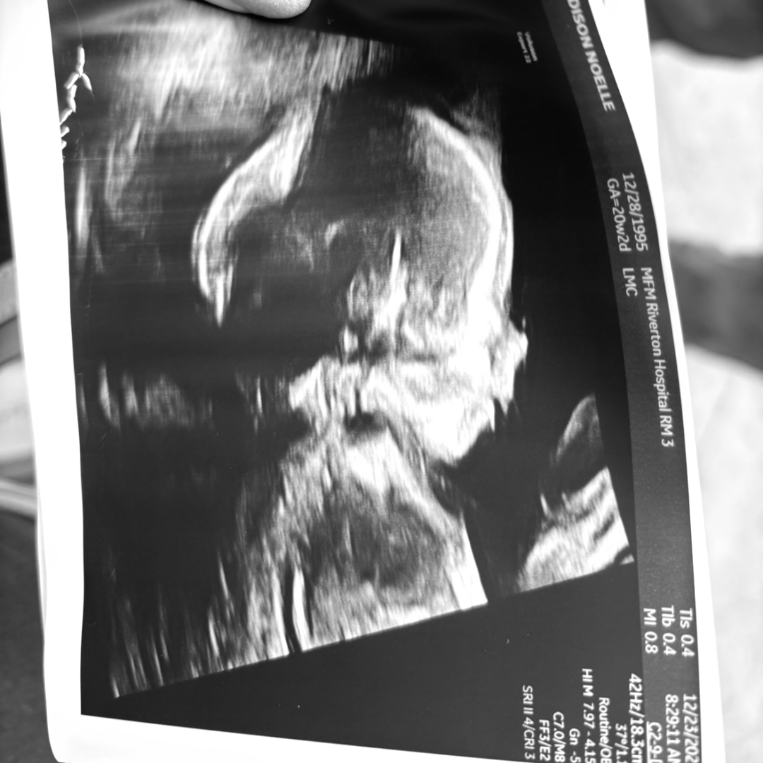 Photo shared by Madison for their Babylist baby registry.