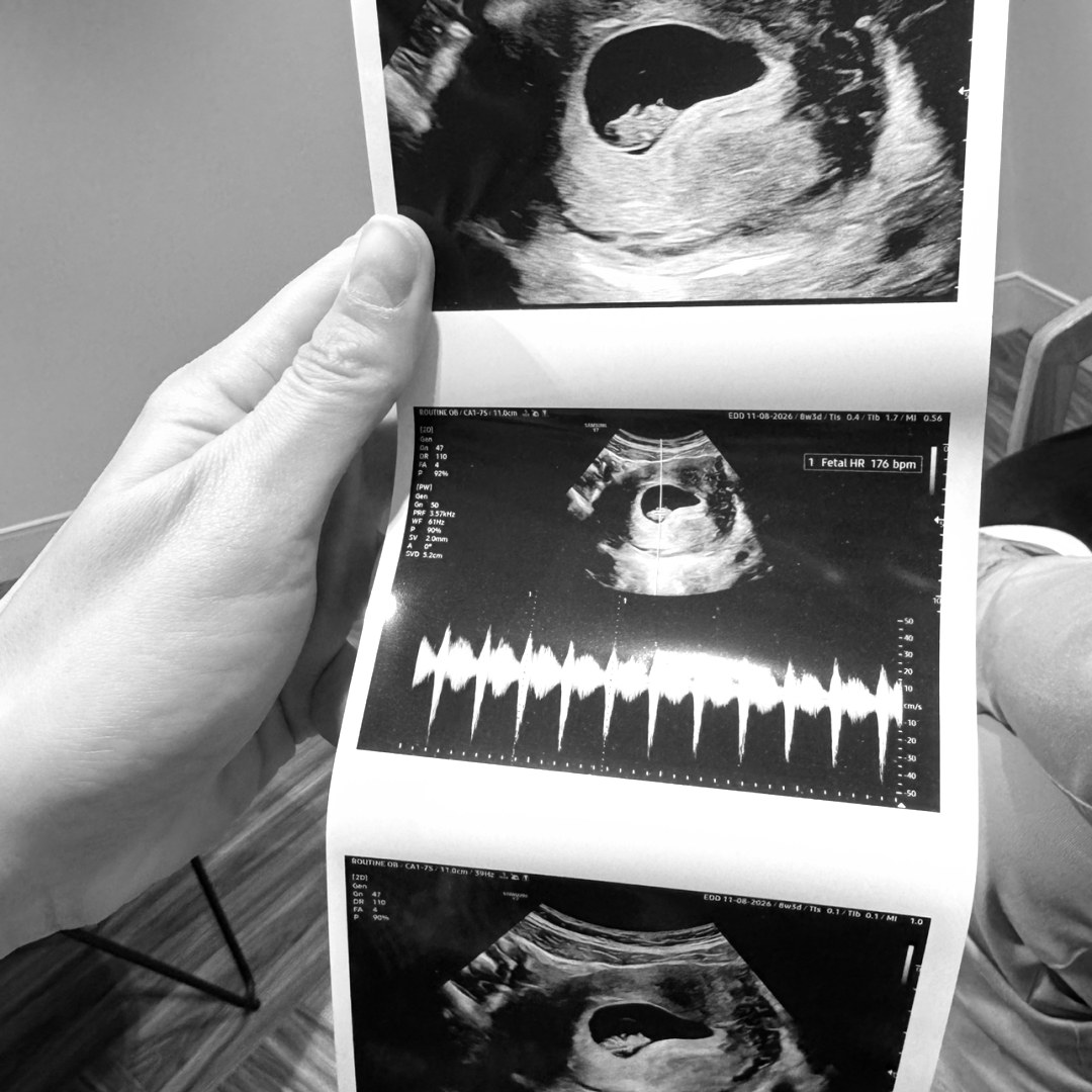 Photo shared by Christina & Sean for their Babylist baby registry.