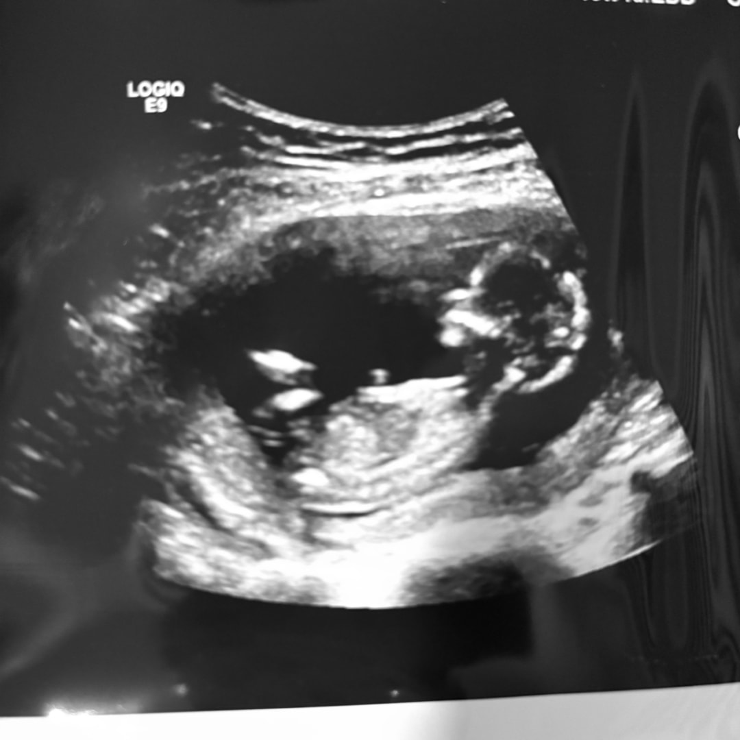 Photo shared by Rosemary for their Babylist baby registry.