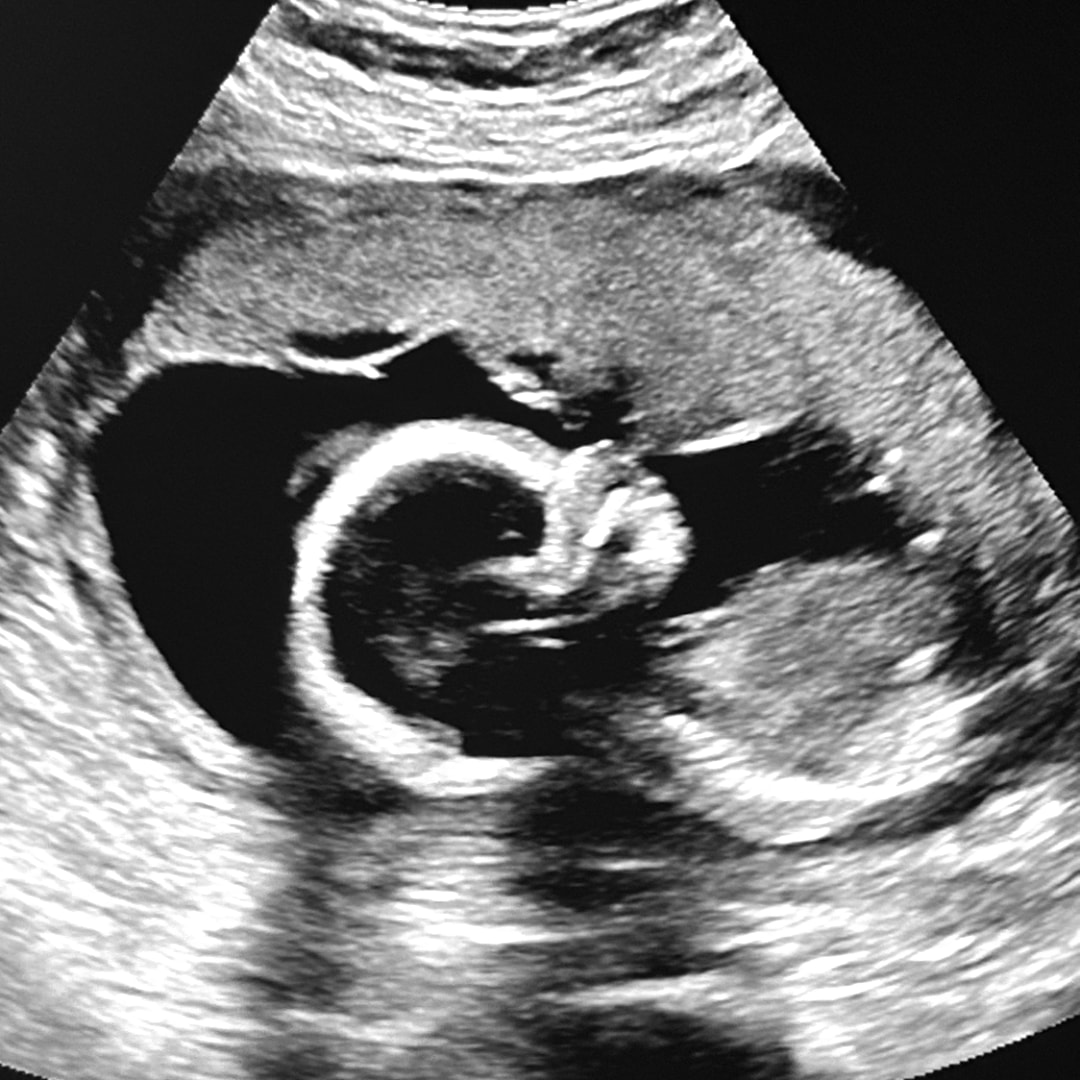 Photo shared by Inez for their Babylist baby registry.