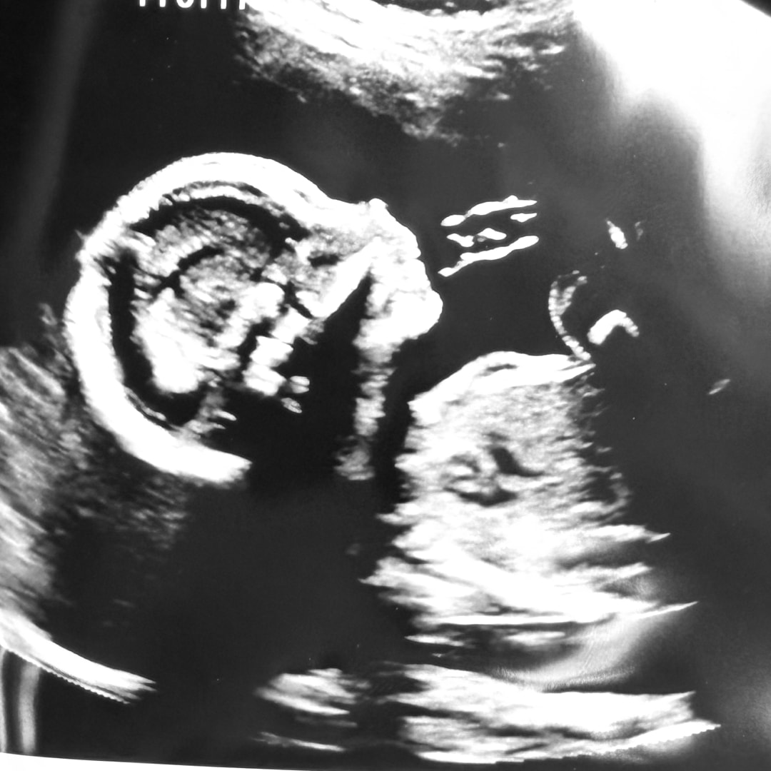 Photo shared by Erin for their Babylist baby registry.