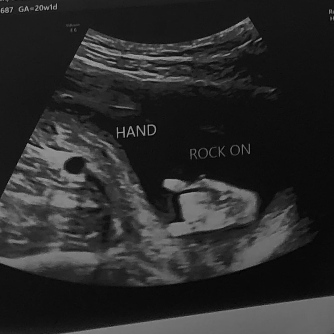 Photo shared by Elizabeth for their Babylist baby registry.
