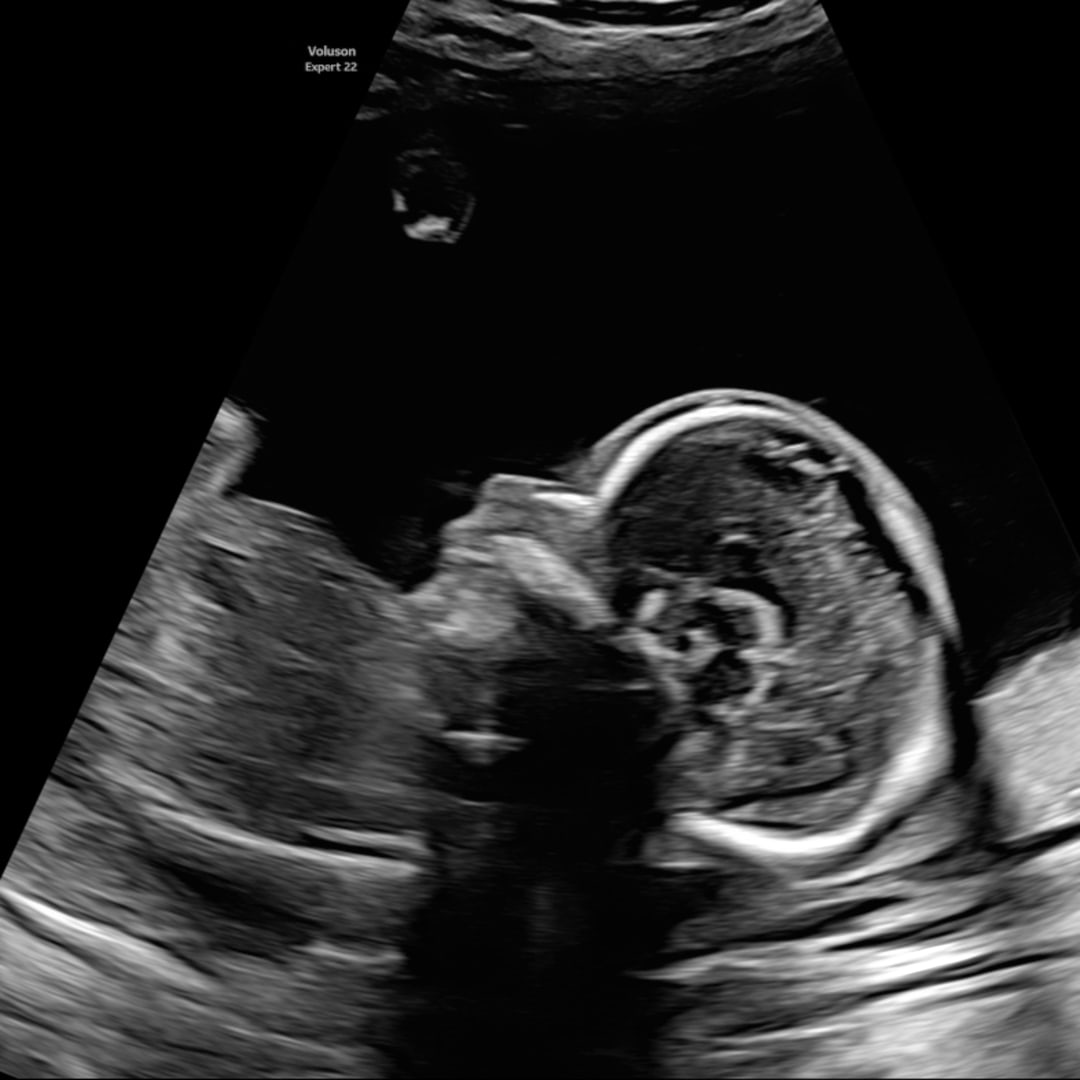 Photo shared by Aaliha for their Babylist baby registry.