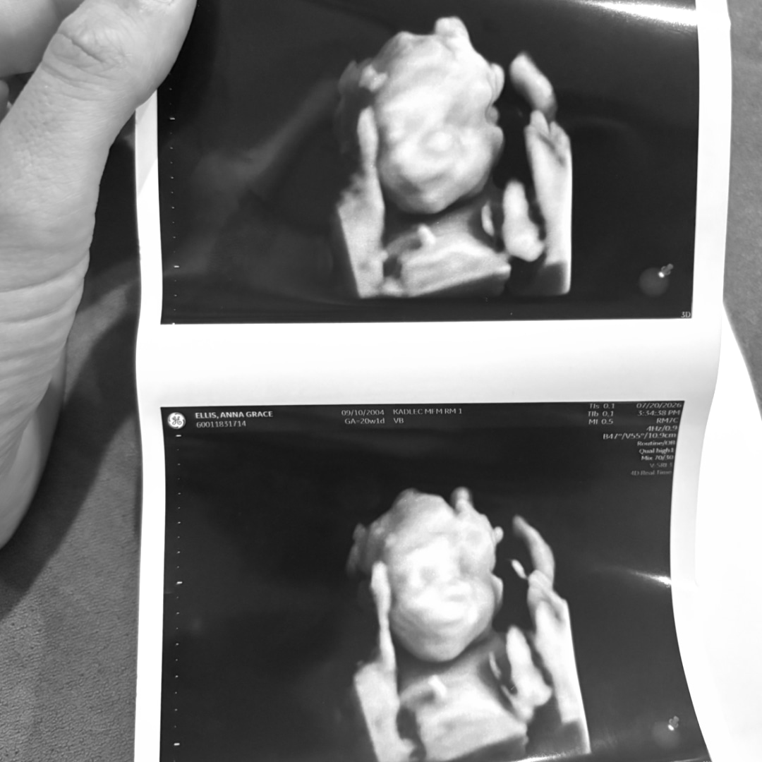 Photo shared by Anna for their Babylist baby registry.