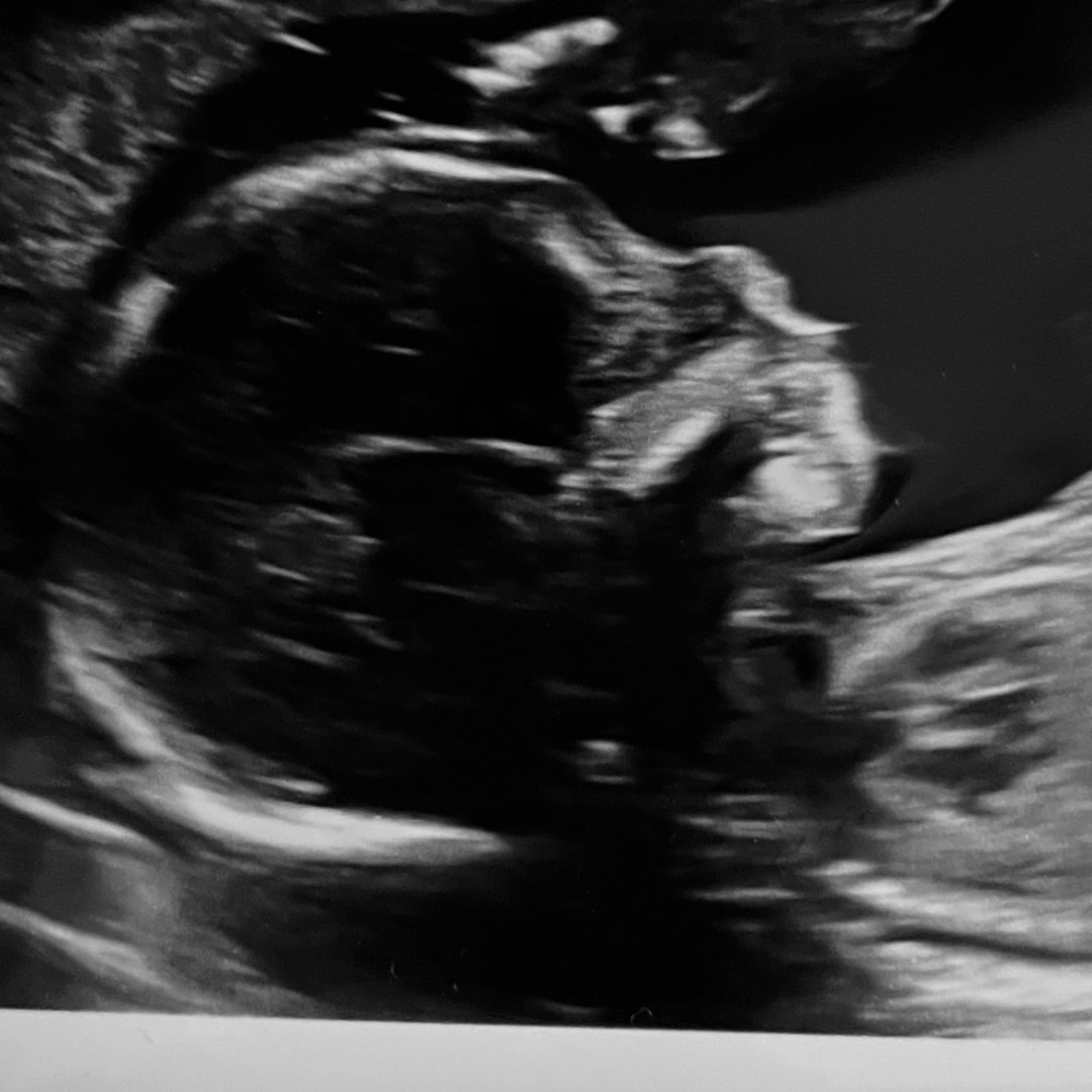 Photo shared by Emma for their Babylist baby registry.