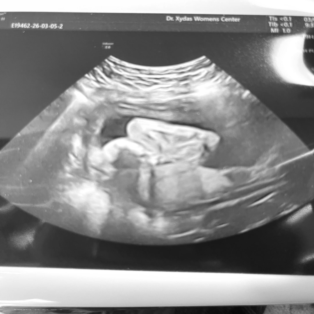 Photo shared by Denise for their Babylist baby registry.