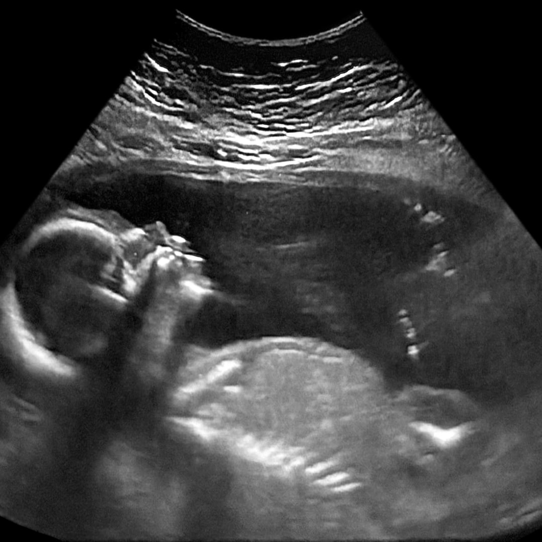 Photo shared by Stephanie for their Babylist baby registry.