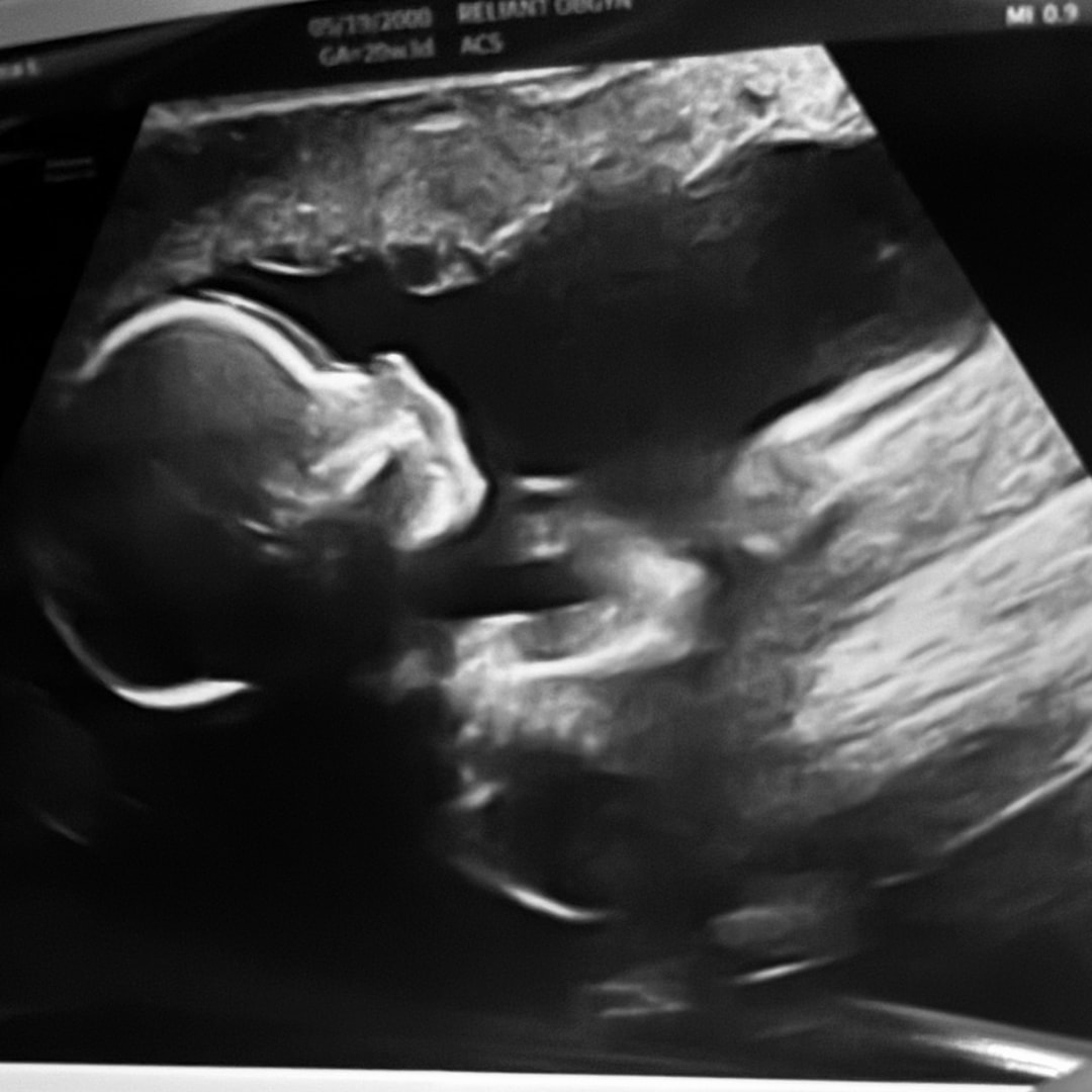 Photo shared by Gianna for their Babylist baby registry.