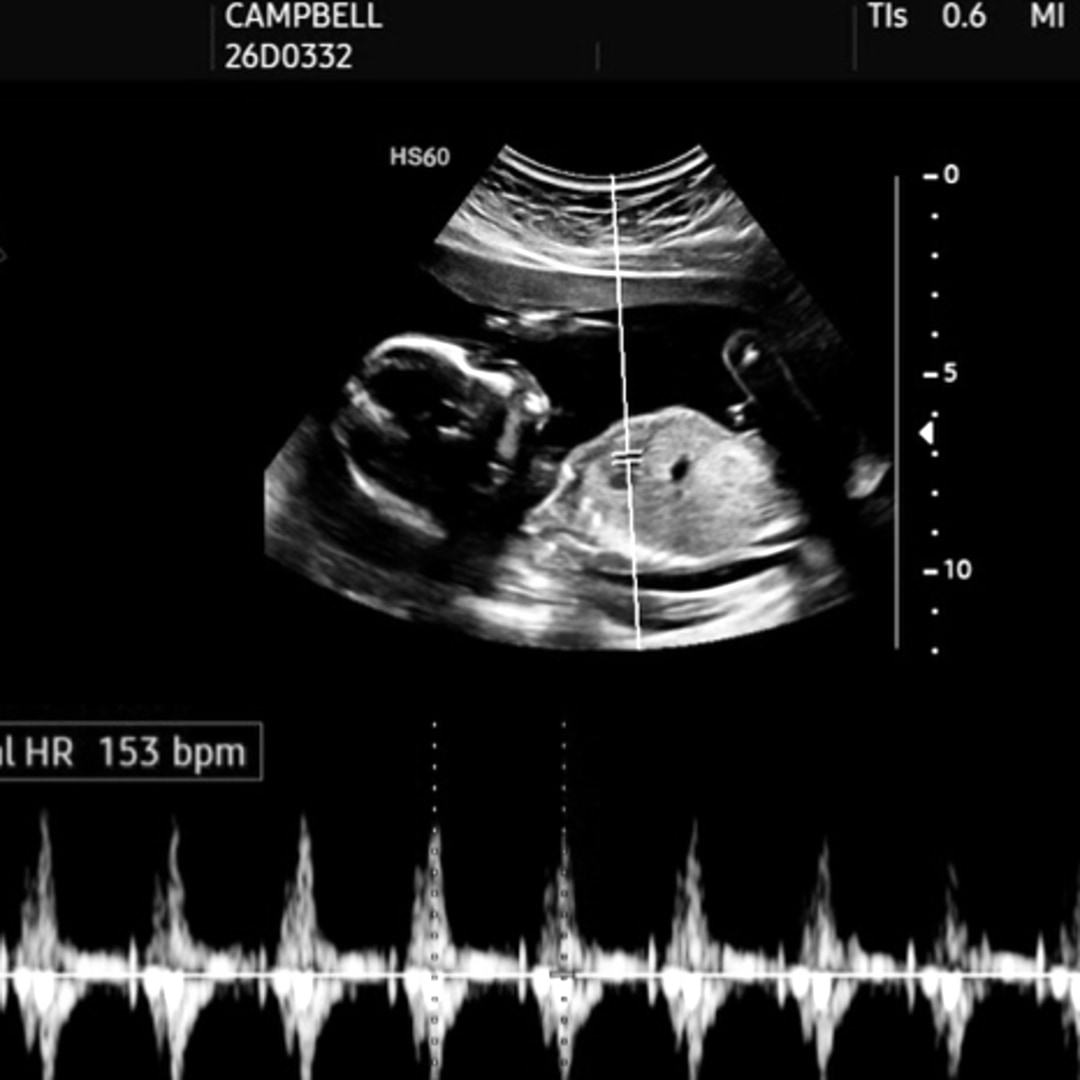 Photo shared by Alana for their Babylist baby registry.